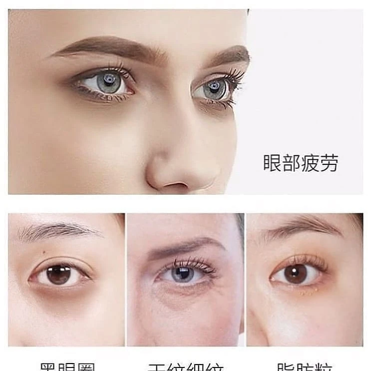 کرم دور چشم خاویار؛؛ نمای شماره 3