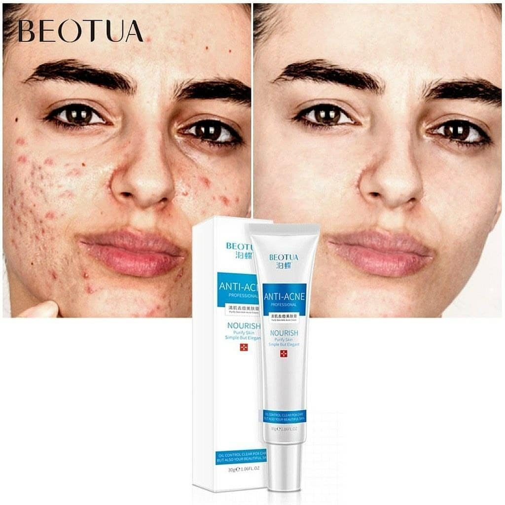 کرم ضدجوش beotua؛ انتخاب کاربردی برای روتین روزانه در گروه مراقبت از پوست