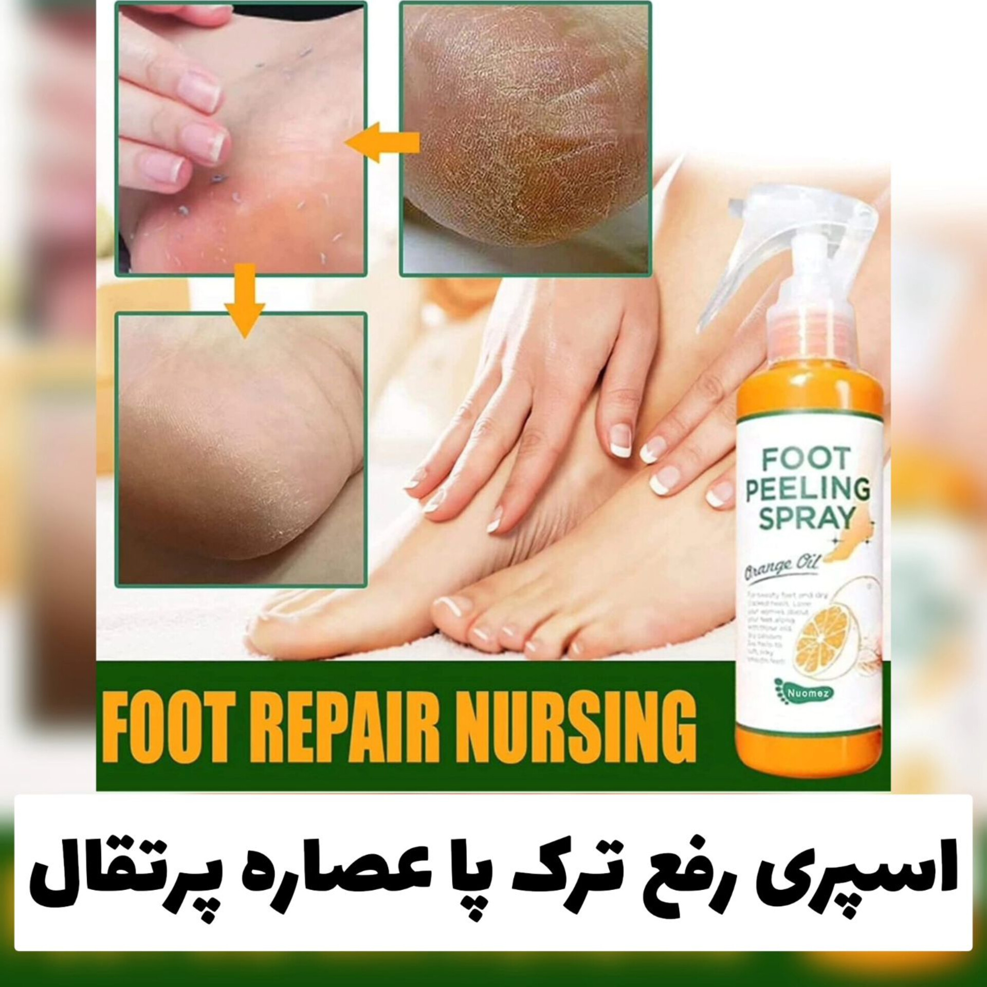 اسپری رفع ترک و خشکی پا foot peeling spray؛ انتخاب کاربردی برای روتین روزانه در گروه مراقبت از پوست؛ نمای شماره 4