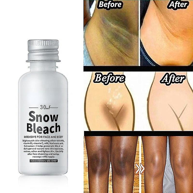 کرم سفیدکننده ناحیه بکینی سفیدبرفی Snow bleach؛ گزینه‌ای مناسب برای تکمیل روتین زیبایی در گروه سفید کننده؛ نمای شماره 6