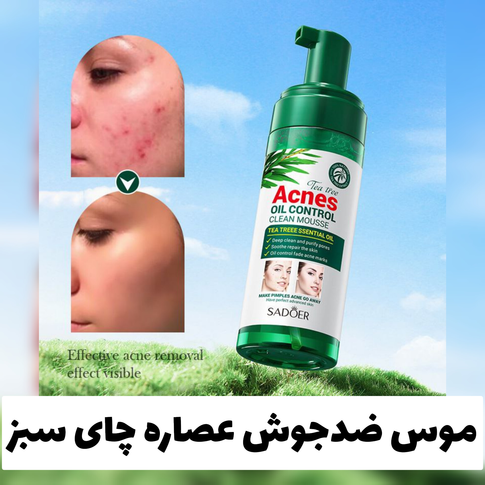 موس صورت ضد جوش عصاره چای سبز؛ گزینه‌ای مناسب برای تکمیل روتین زیبایی در گروه ضدجو‌ش